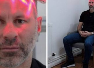After ‘stress of played for man Utd Ryan Giggs undergoes hair transplant After 'stress of played for man Utd Ryan Giggs undergoes hair transplant