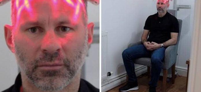 After 'stress of played for man Utd Ryan Giggs undergoes hair transplant