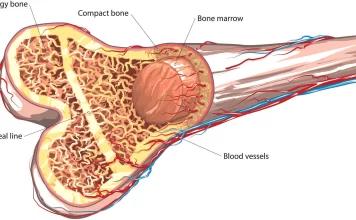 Bone Marrow and Stem Cell Transplantation Center in Bangkok Bone Marrow and Stem Cell Transplantation